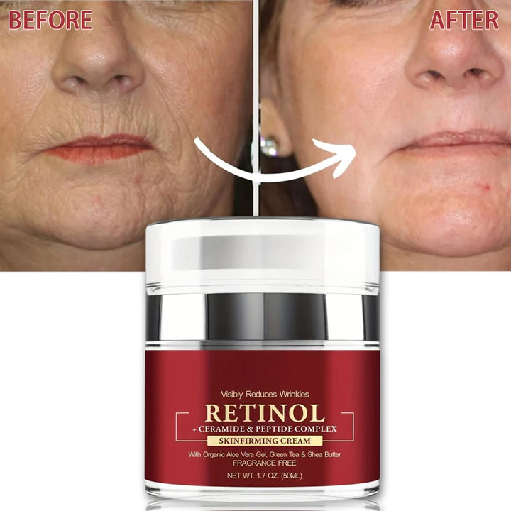 Instant Retinol Cream Wrinkle Remover Firming Lifting Anti Aging Fade Fine